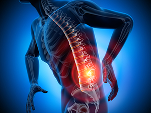 狭窄 管 リハビリ 症 脊柱 腰部 血流改善のために！脊柱管狭窄症・術後の内容一覧